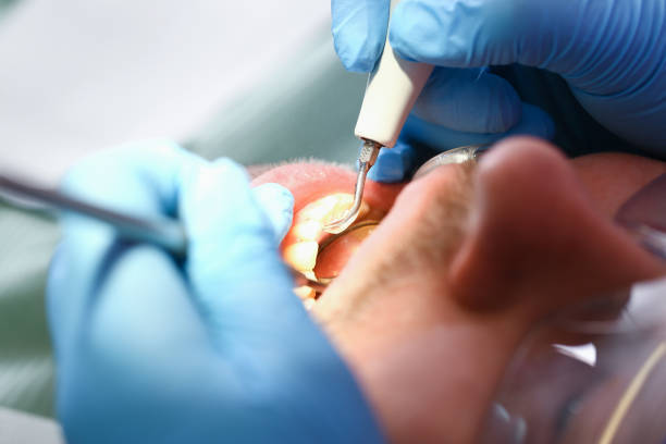 Best Mobile Emergency Dentist in Edenton, NC