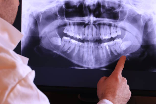 Best Emergency Root Canal Treatment in Edenton, NC