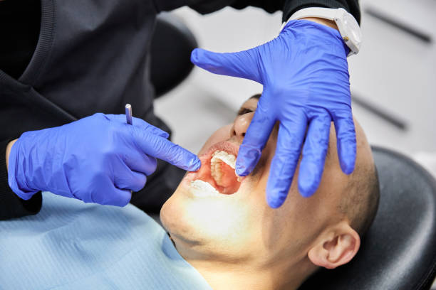 Best Emergency Dental Care for Abscessed Tooth in Edenton, NC