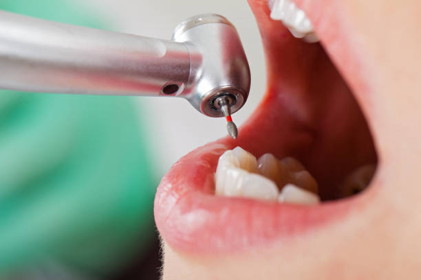 Best Weekend Emergency Dentist in Edenton, NC